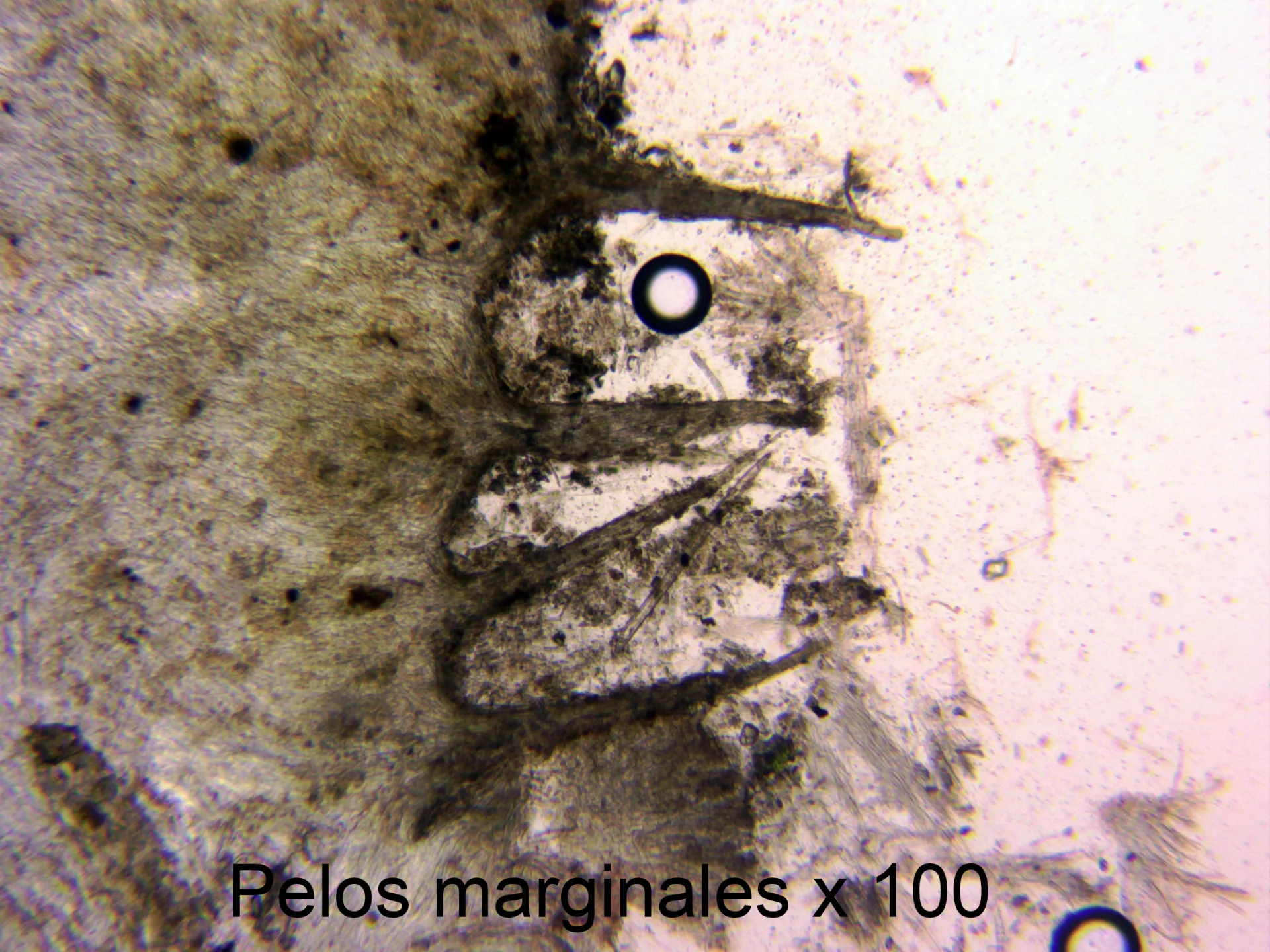 13 - Pelos marginales x 100